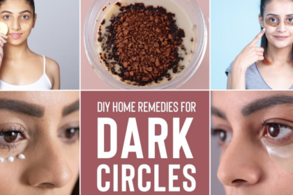 Best Remedies to Reduce Dark Circles