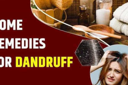 Home Remedies for Dandruff