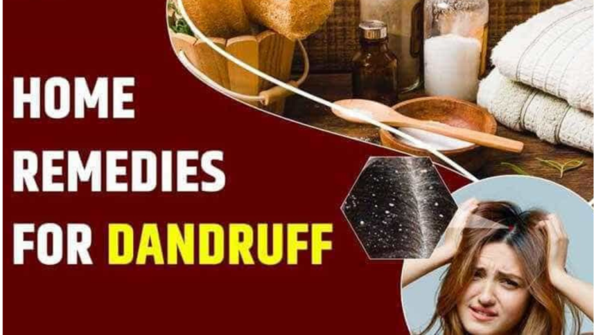 Home Remedies for Dandruff